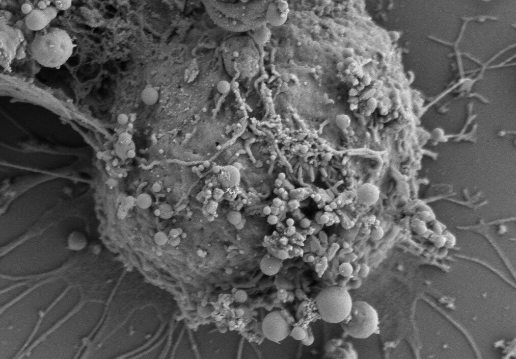 CTC with vesicles